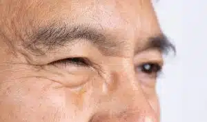a man with one of his eyes closed